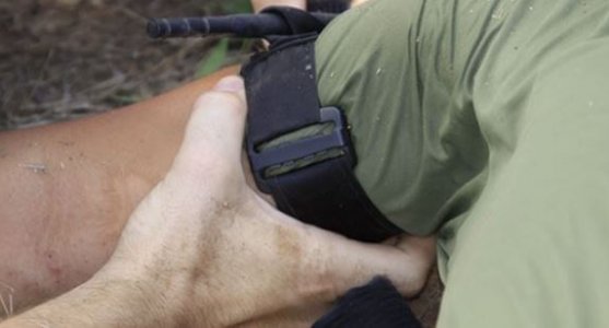 Артериальное кровотечение